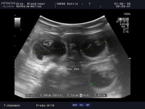 Ultraschall Dottie 2026